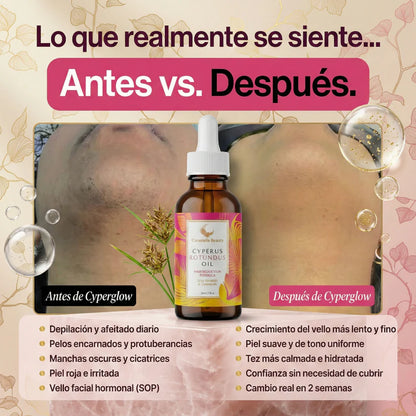 Cyperus Rotundus Oil (60 ml) | Reduce naturalmente el vello