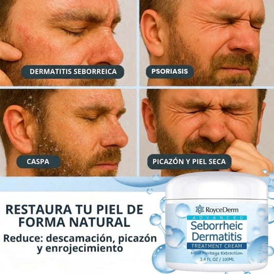 Seborrheic Dermatitis | Calma la picazón, borra la caspa y restaura tu piel